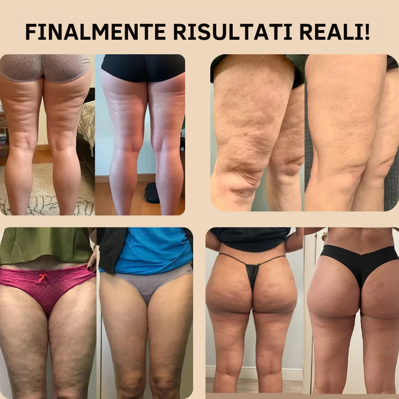 Leggings anti-cellulite ad alte prestazioni con tasche