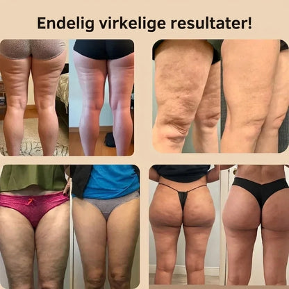 Cellufri 3D Formande Anti-Cellulit Leggings